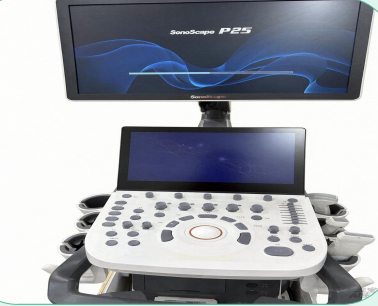 Doppler Ultrasound thumbnail 2