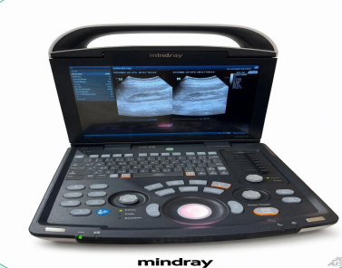 Doppler Ultrasound thumbnail 4