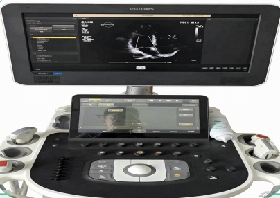 Doppler Ultrasound thumbnail 5